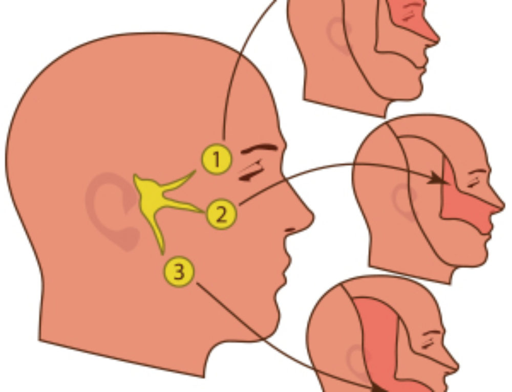 trigeminal-neuralgia-treatment-options-in-san-diego-ca-upper